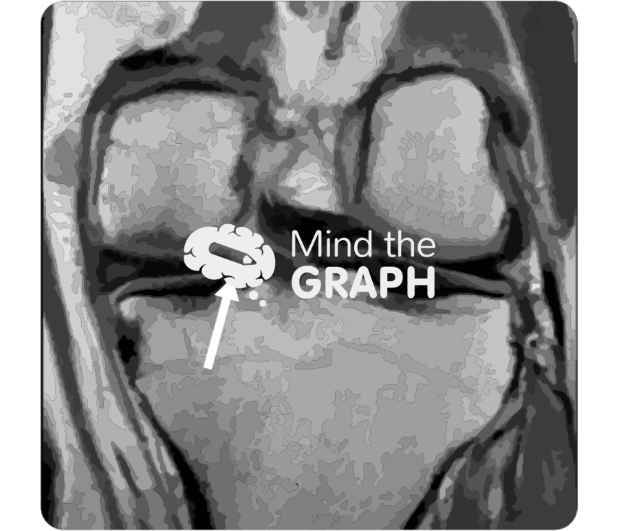Meniscus root tear mri Icons, Symbols, Pictures, and Images