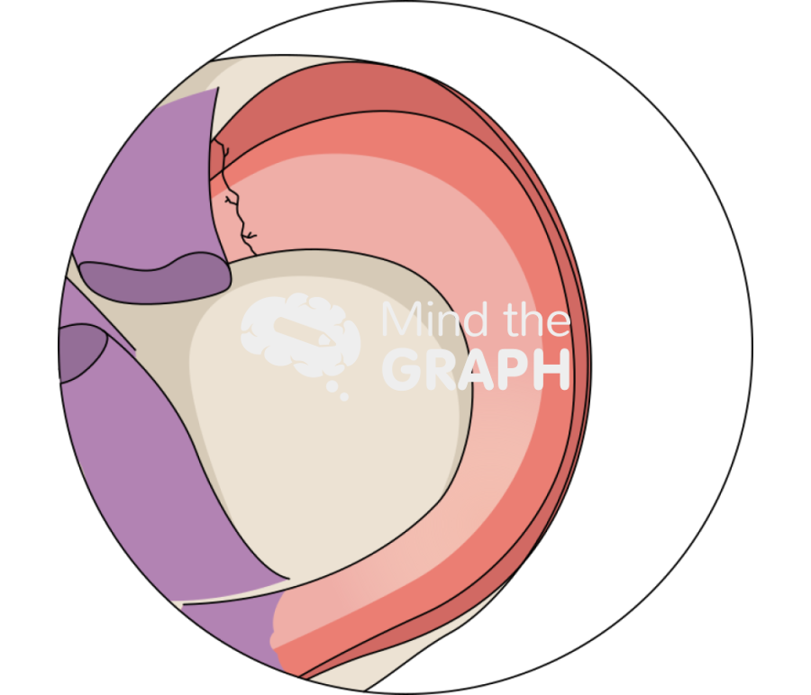 Meniscus root tear zoom Icons, Symbols, Pictures, and Images