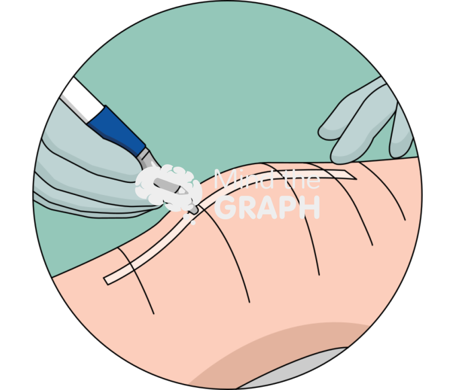 Mesh dressing zoom Icons, Symbols, Pictures, and Images
