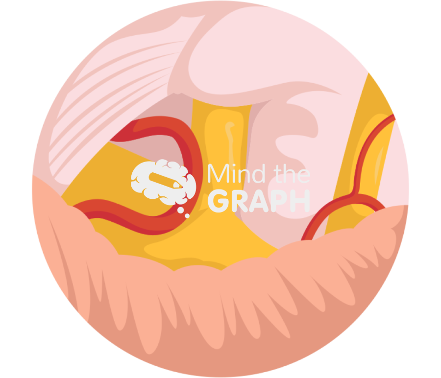 Microvascular decompression trigeminal neuralgia zoom 1 Icons, Symbols, Pictures, and Images