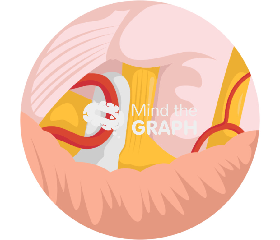 Microvascular decompression trigeminal neuralgia zoom 2 Icons, Symbols, Pictures, and Images