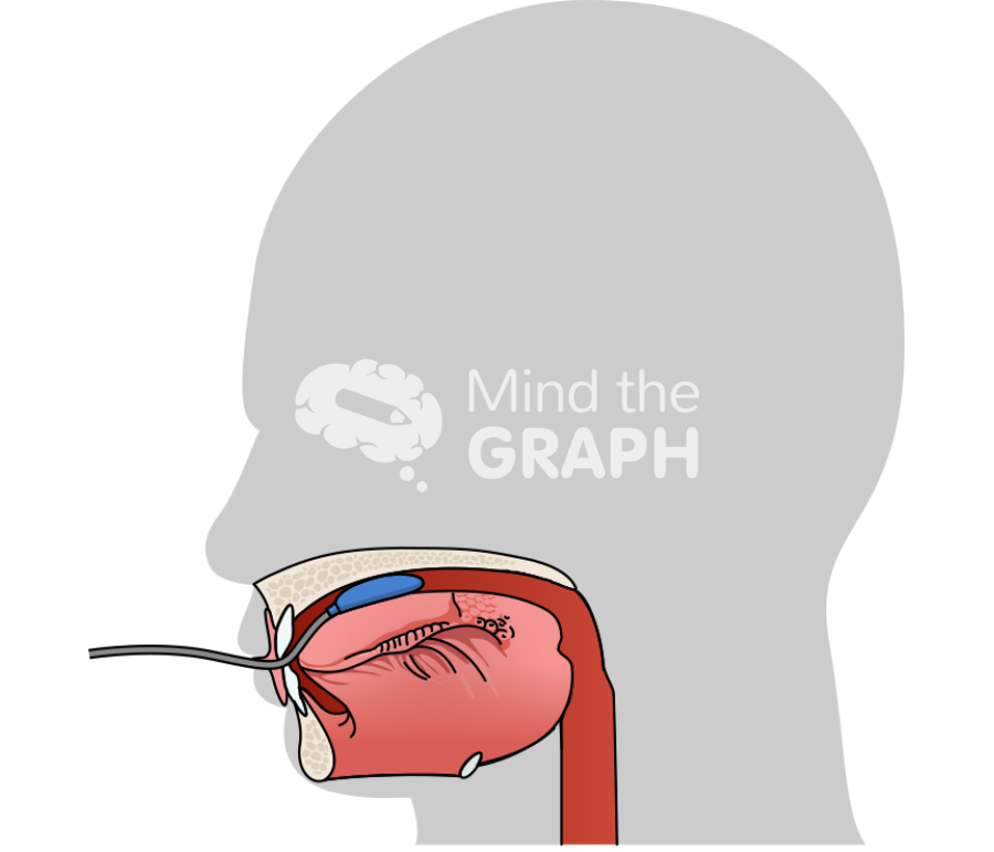 Mid iopi device tongue shape lateral Icons, Symbols, Pictures, and Images