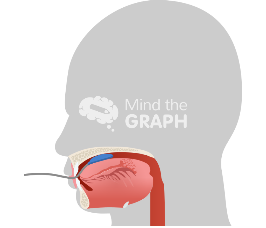 Mid iopi device tongue shape lateral Icons, Symbols, Pictures, and Images