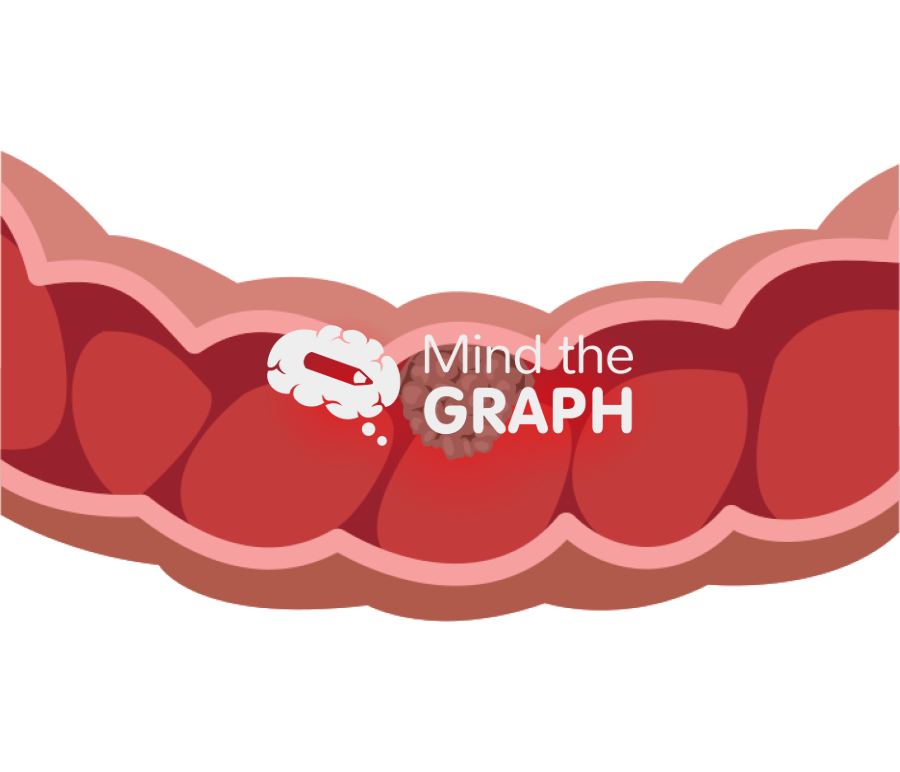 Middle cancer colon intestine Icons, Symbols, Pictures, and Images