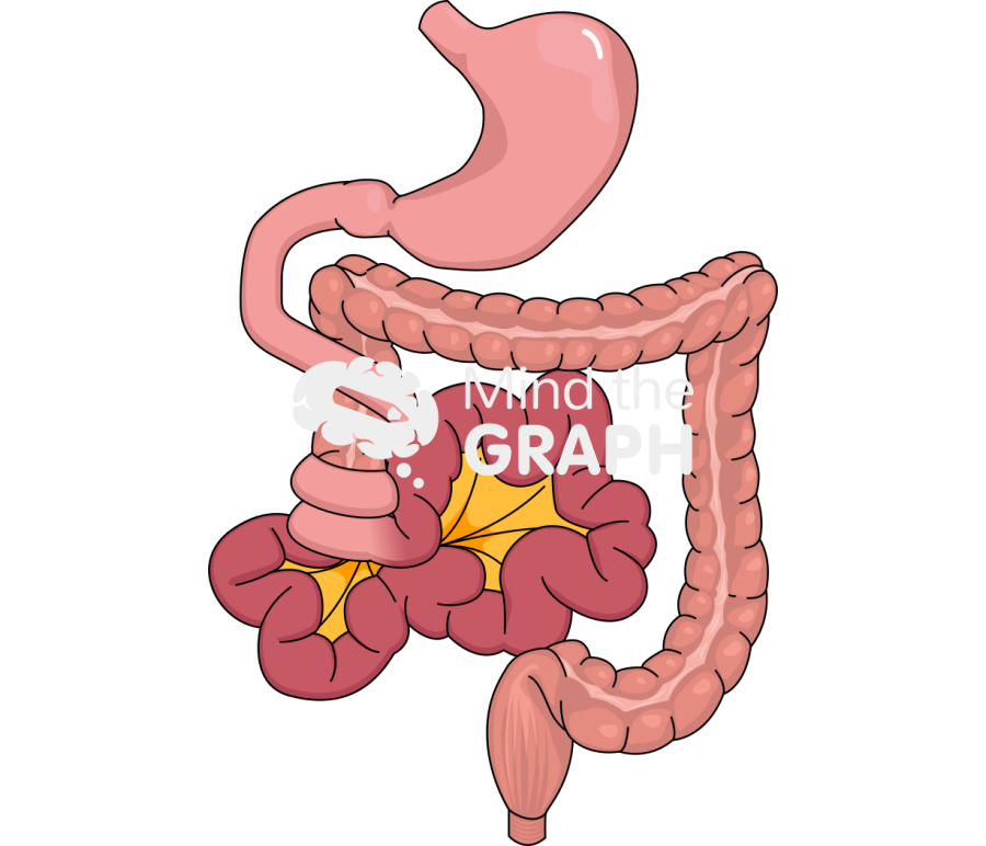 Midgut volvulus Icons, Symbols, Pictures, and Images