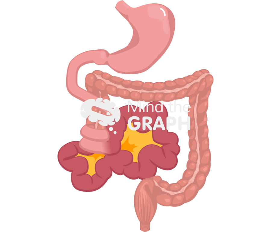Midgut volvulus Icons, Symbols, Pictures, and Images