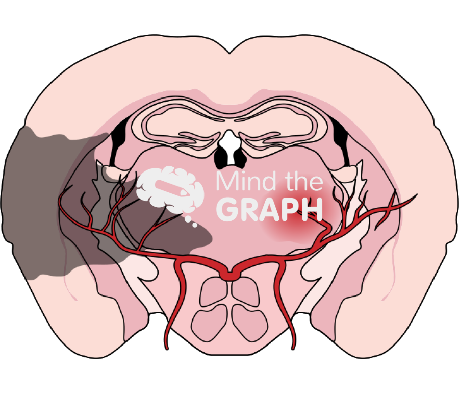 Mouse brain non extensive cerebral infarction and hemorrhage front cut Icons, Symbols, Pictures, and Images