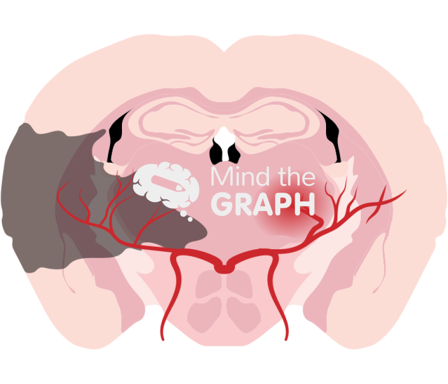 Mouse brain non extensive cerebral infarction and hemorrhage front cut Icons, Symbols, Pictures, and Images
