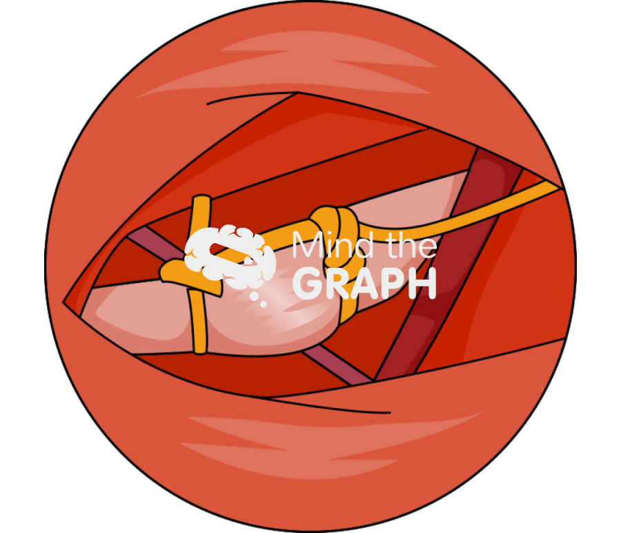 Mouse ion nervous surgery 2 zoom Icons, Symbols, Pictures, and Images