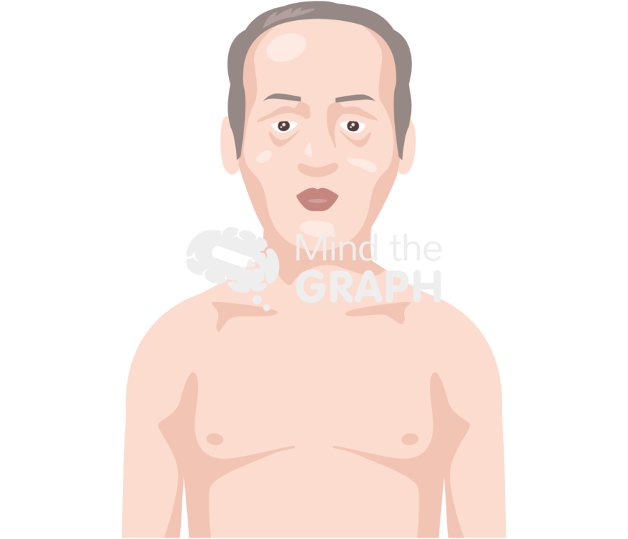 Myotonic dystrophy symptom man caucasian frontal Icons, Symbols, Pictures, and Images