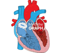 Neonatal ventricular disproportion type a Icons, Symbols, Pictures, and Images