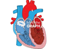 Neonatal ventricular disproportion type b Icons, Symbols, Pictures, and Images