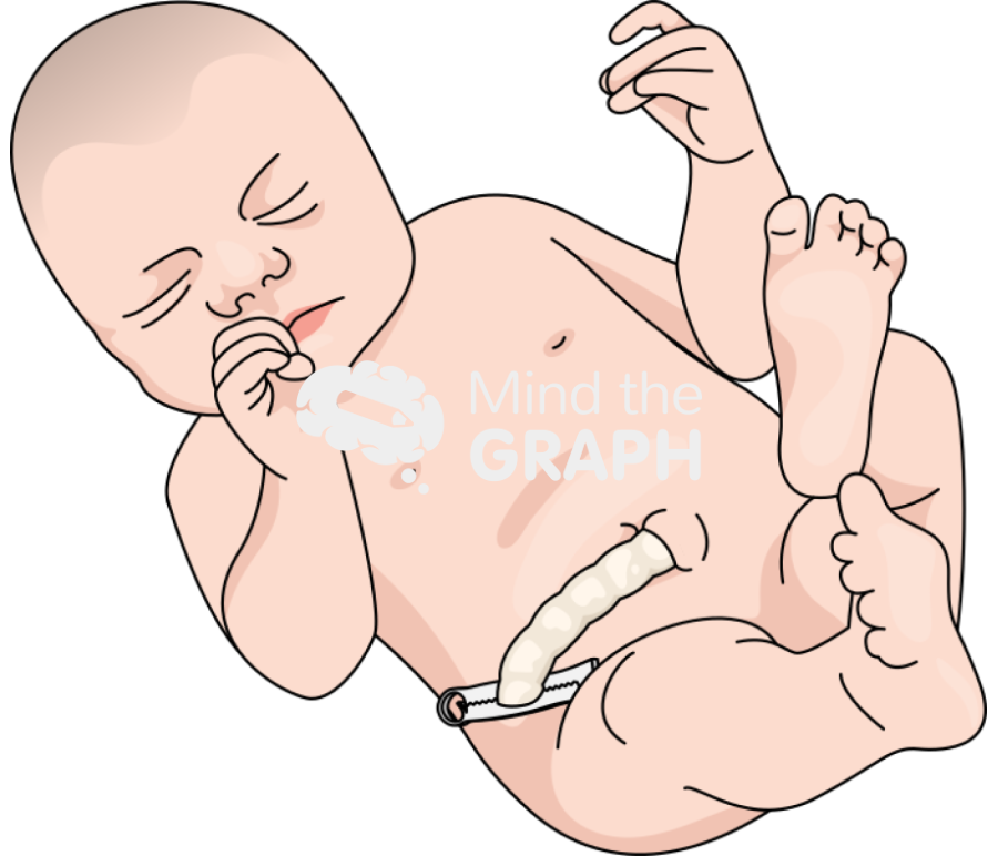 Newborn infant umbilical cord caucasian Icons, Symbols, Pictures, and Images