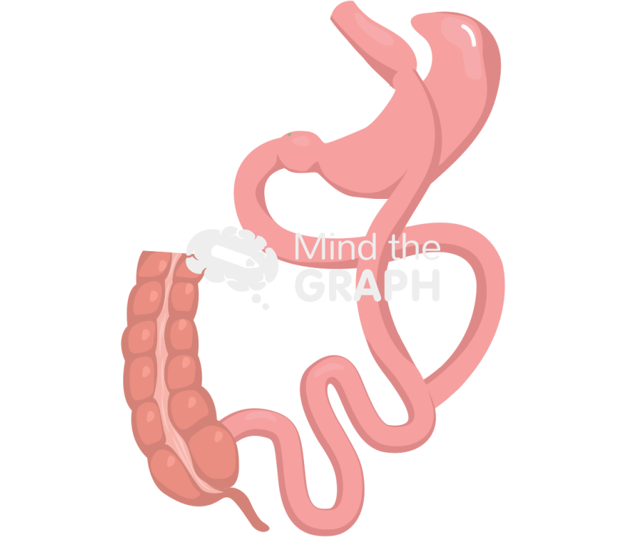 Nissen bypass 1 Icons, Symbols, Pictures, and Images