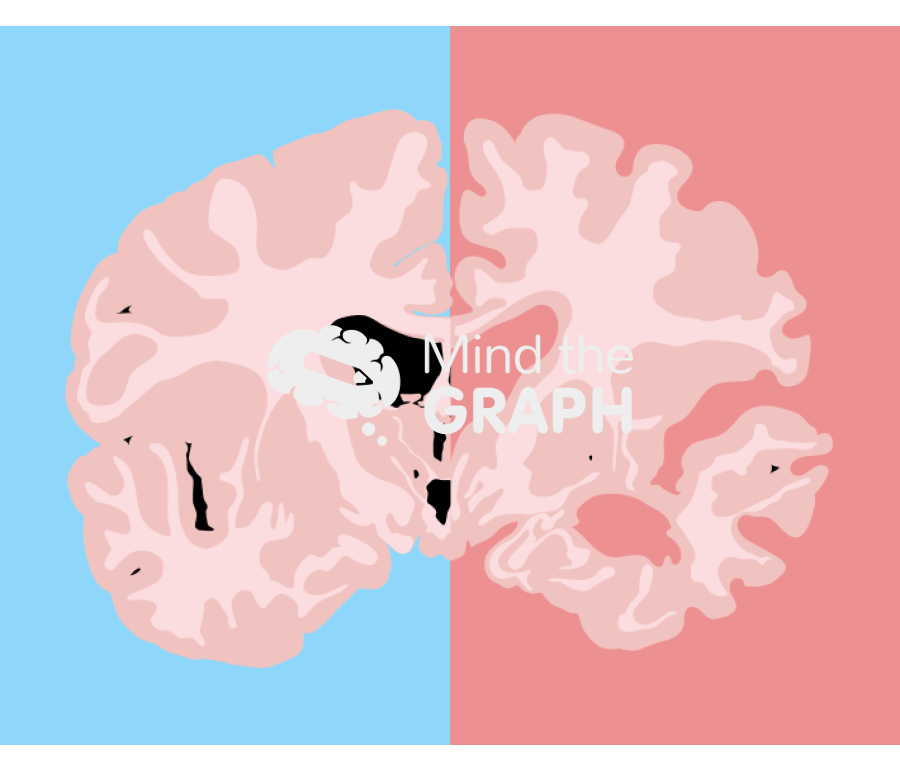 Normal and alzheimer brain front cut Icons, Symbols, Pictures, and Images