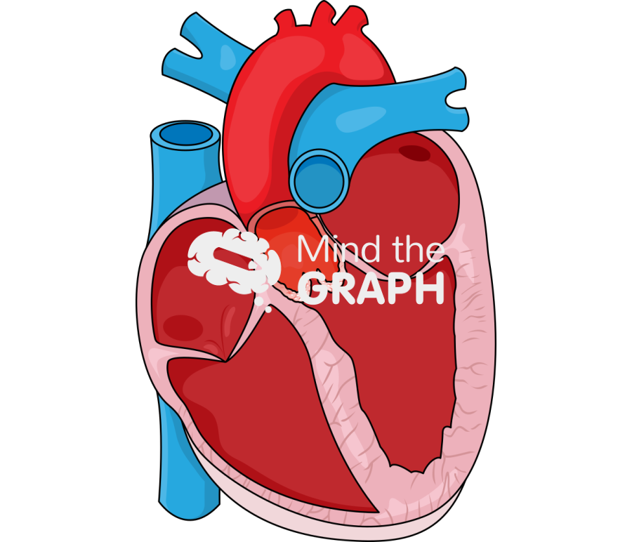 Normal flow low gradient aortic stenosis Icons, Symbols, Pictures, and Images