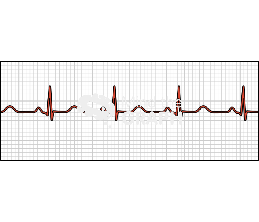 Normal healthy electrocardiogram Icons, Symbols, Pictures, and Images