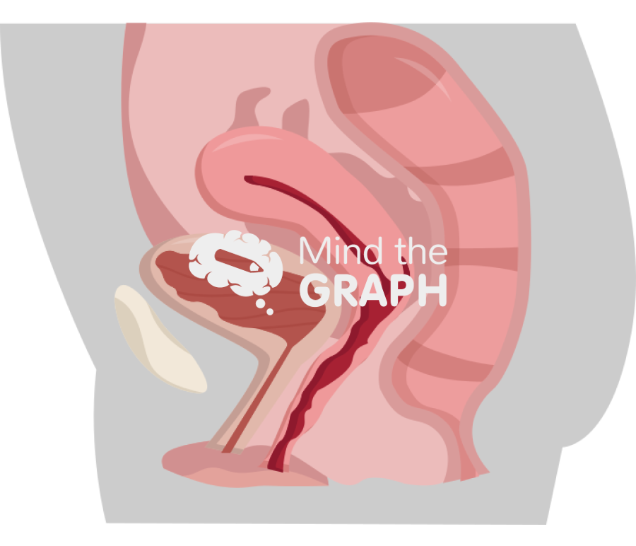 Normal uterus Icons, Symbols, Pictures, and Images