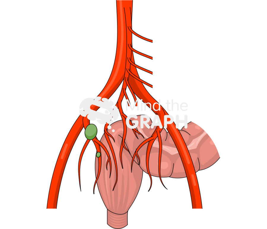 Obturator internal iliac pelvic lymph node 2 Icons, Symbols, Pictures, and Images