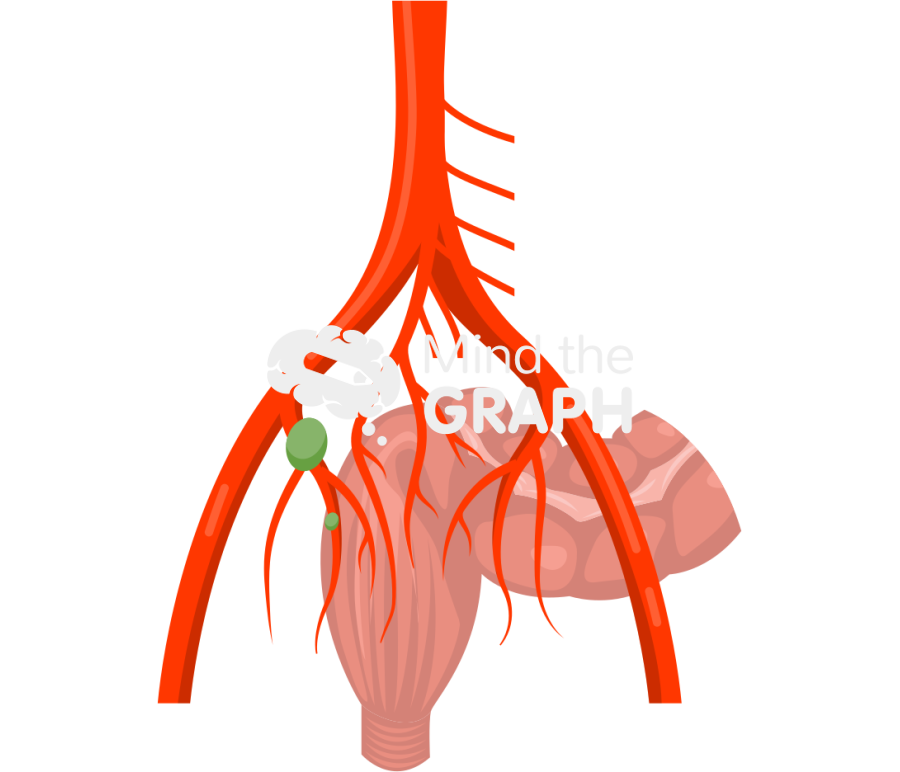 Obturator internal iliac pelvic lymph node 2 Icons, Symbols, Pictures, and Images