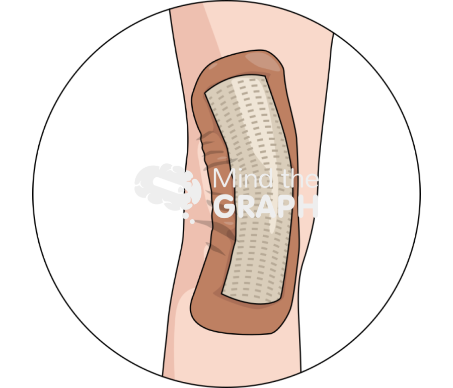 Occlusive dressing total knee arthroplasty body zoom Icons, Symbols, Pictures, and Images