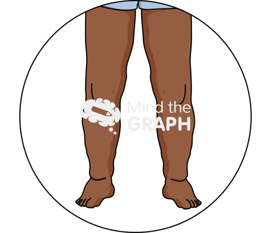 Oedema Icons, Symbols, Pictures, and Images