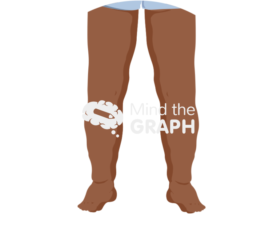 Oedema Icons, Symbols, Pictures, and Images