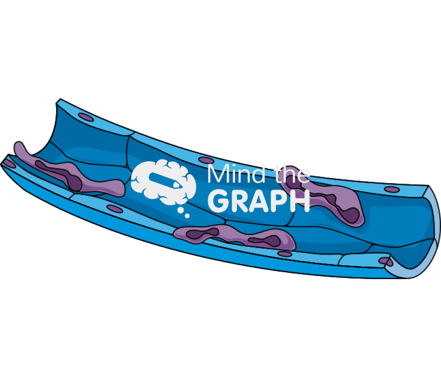 Oedema 1 Icons, Symbols, Pictures, and Images