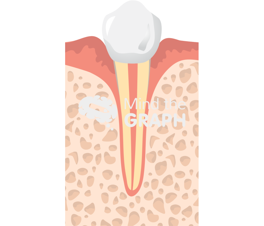 Onto metal substrate tooth Icons, Symbols, Pictures, and Images