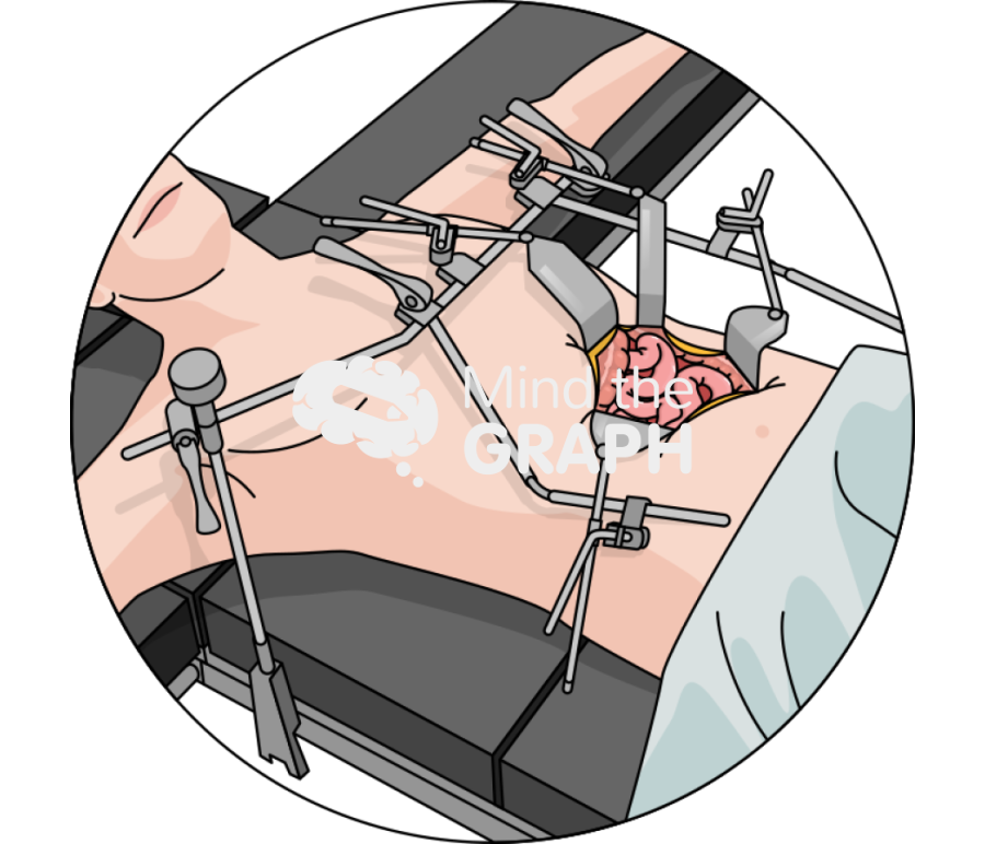 Open abdominal incision zoom Icons, Symbols, Pictures, and Images