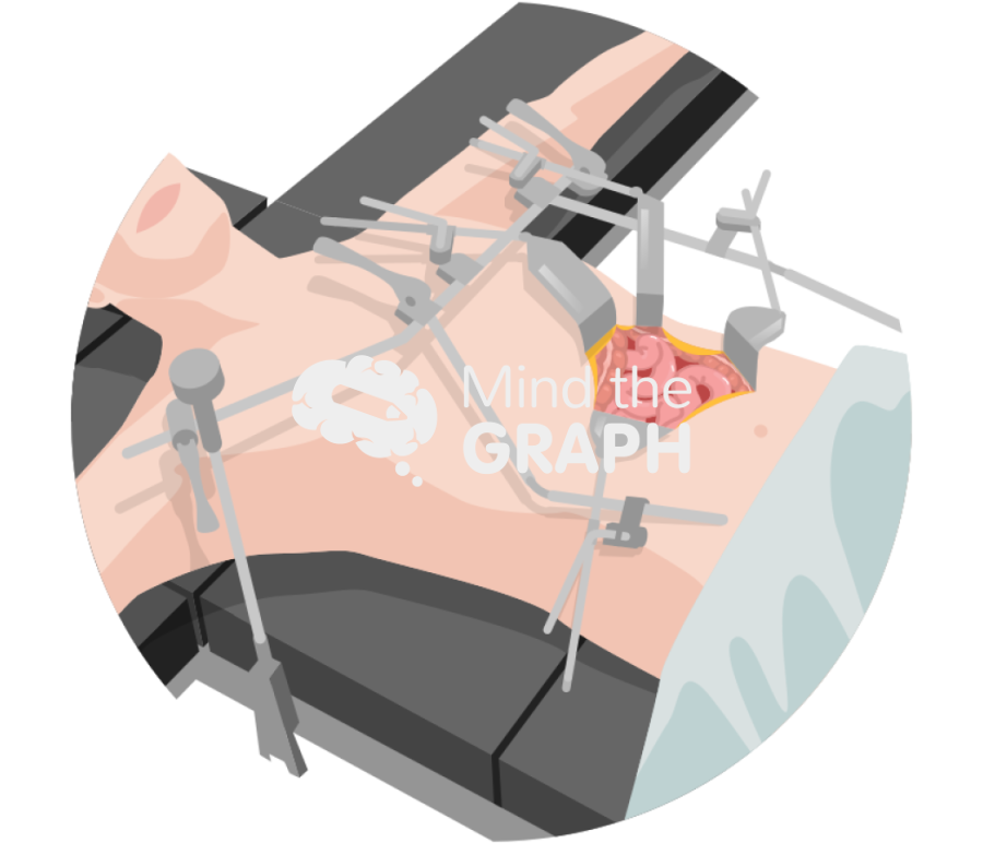 Open abdominal incision zoom Icons, Symbols, Pictures, and Images