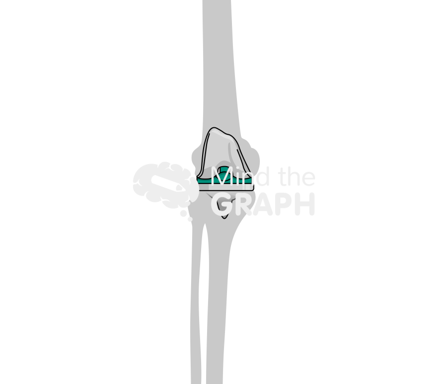 Orthosensor bone Icons, Symbols, Pictures, and Images