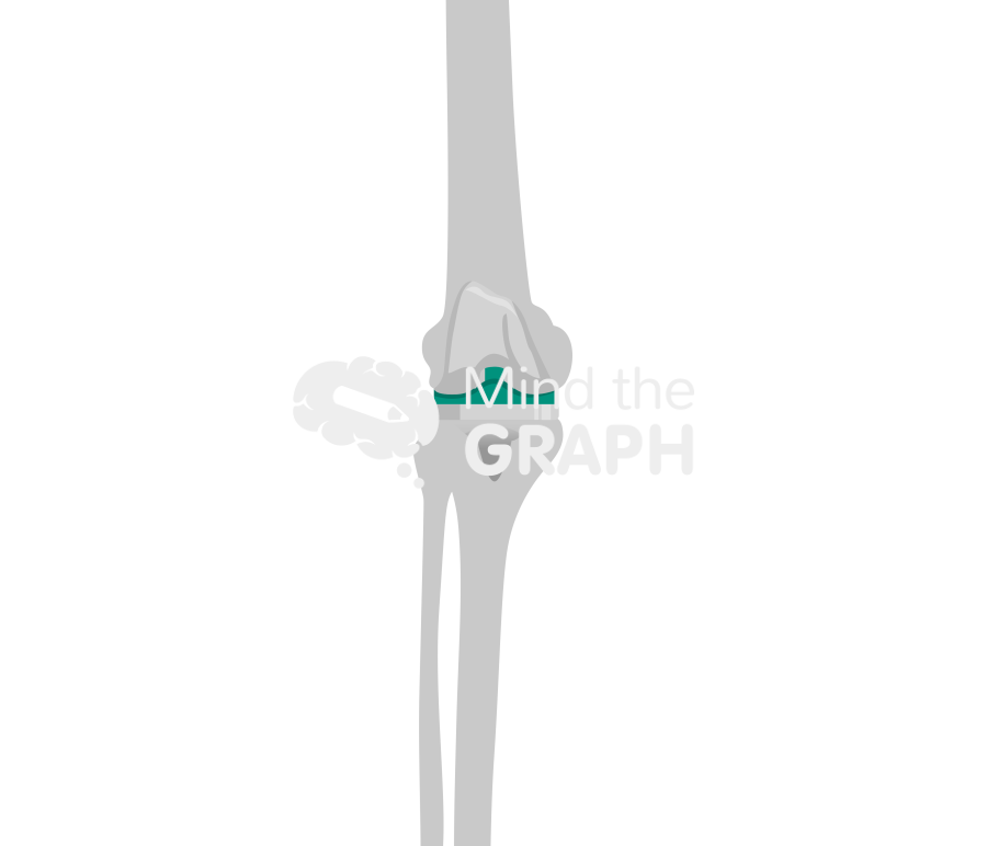 Orthosensor bone Icons, Symbols, Pictures, and Images