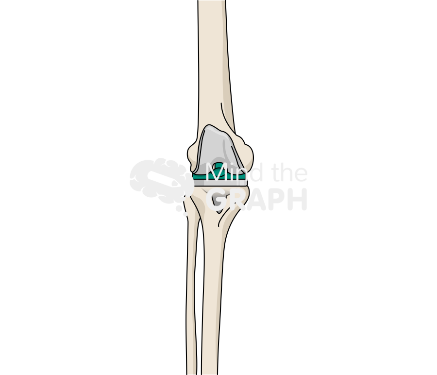 Orthosensor bone full Icons, Symbols, Pictures, and Images