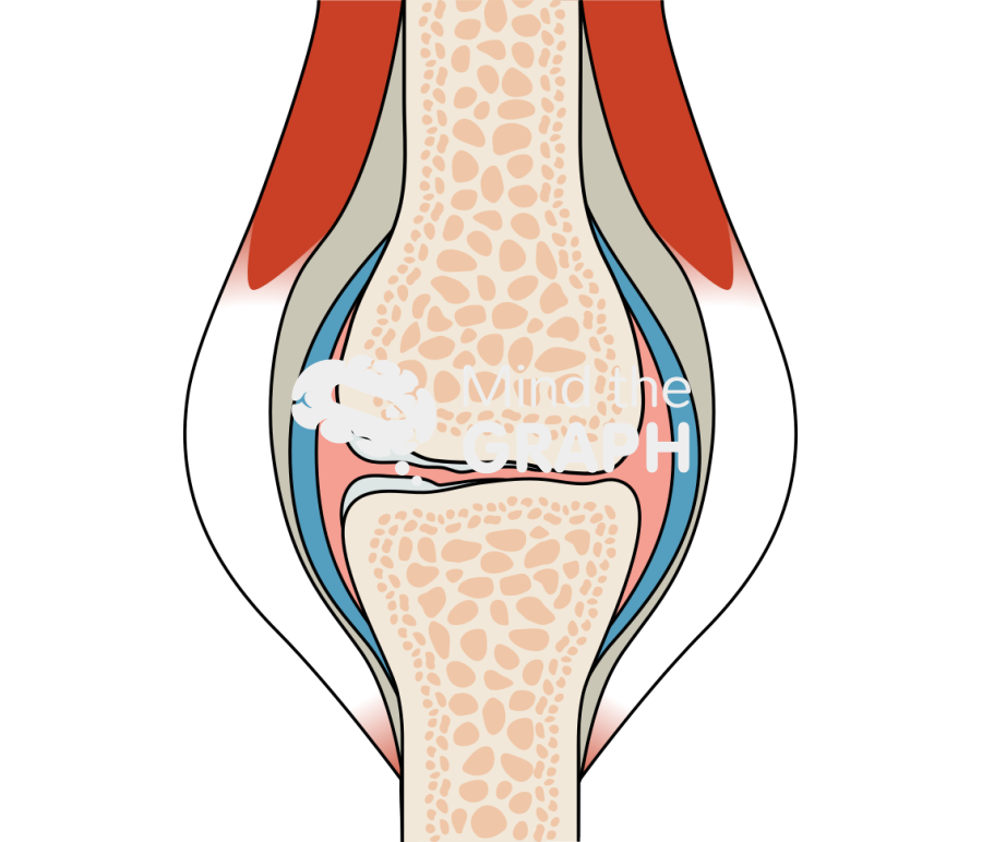 Osteoarthritis joint Icons, Symbols, Pictures, and Images