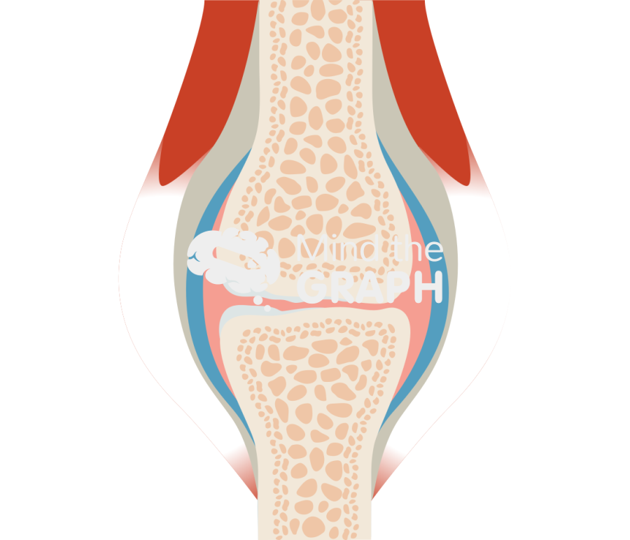 Osteoarthritis joint Icons, Symbols, Pictures, and Images