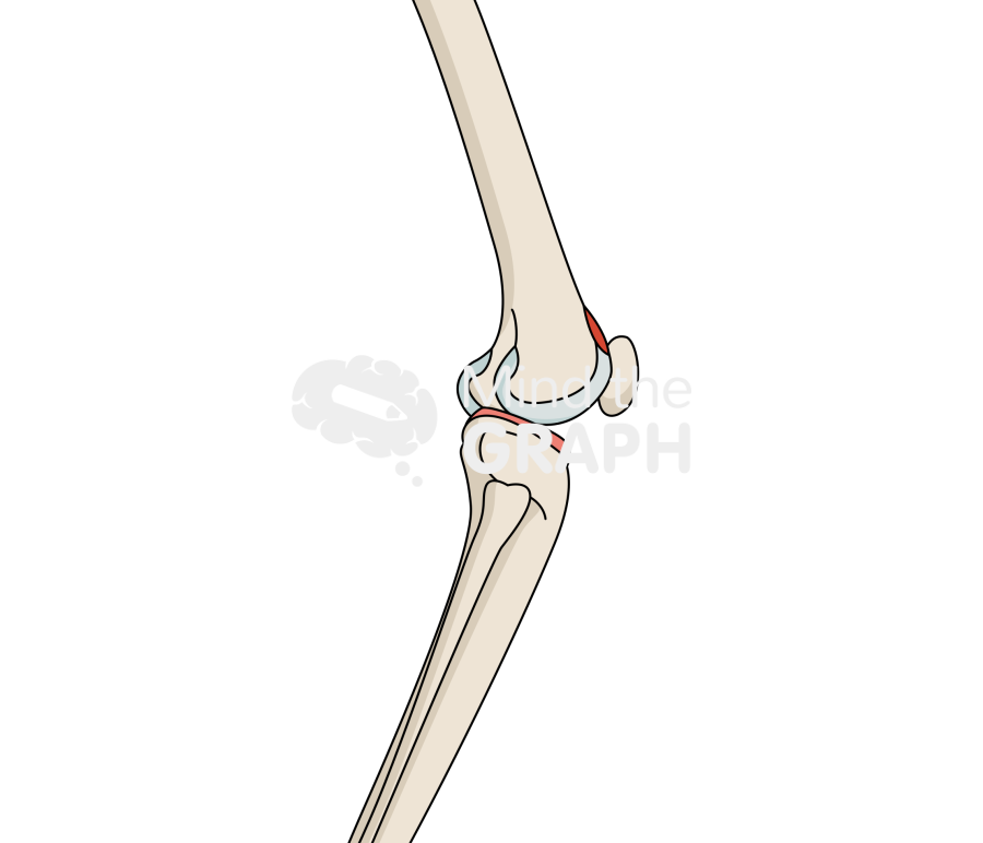 Osteonecrosis anterior knee bone full Icons, Symbols, Pictures, and Images