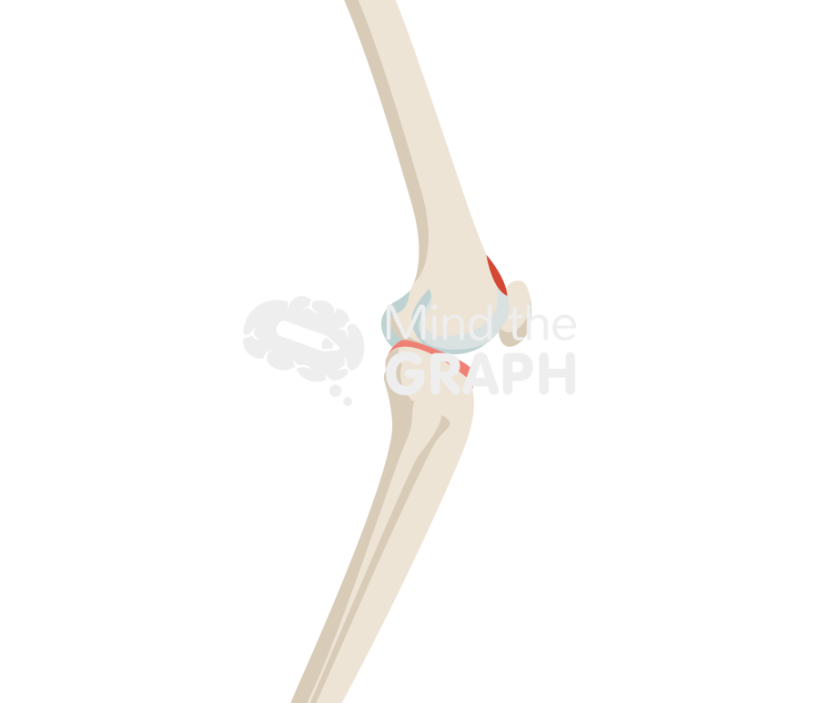 Osteonecrosis anterior knee bone full Icons, Symbols, Pictures, and Images