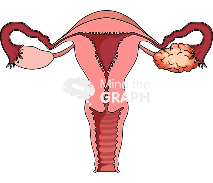 Ovarian cancer front cut Icons, Symbols, Pictures, and Images