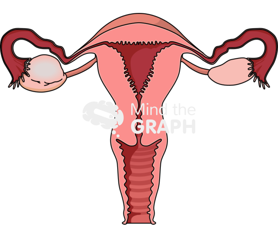 Ovarian cyst front Icons, Symbols, Pictures, and Images