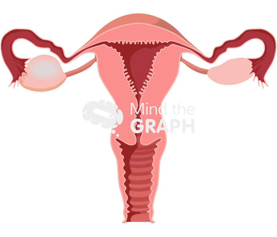 Ovarian cyst front Icons, Symbols, Pictures, and Images