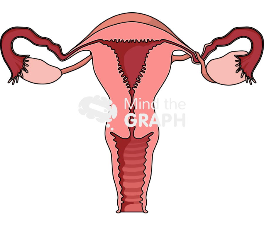 Ovarian torsion front Icons, Symbols, Pictures, and Images