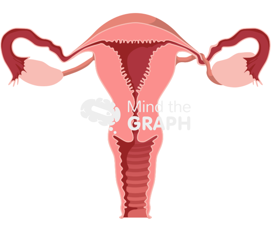 Ovarian torsion front Icons, Symbols, Pictures, and Images