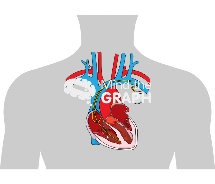 Pacemaker body Icons, Symbols, Pictures, and Images