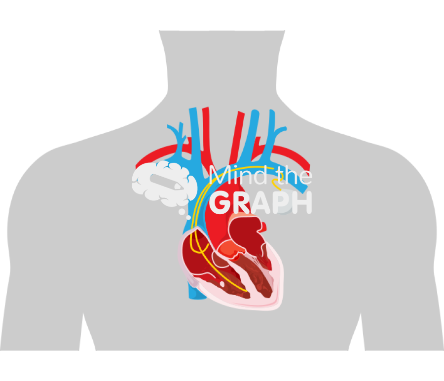 Pacemaker body Icons, Symbols, Pictures, and Images