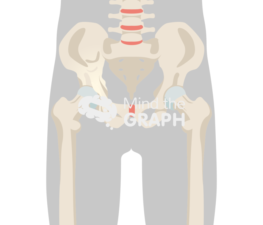 Pagets disease hip arthritis body Icons, Symbols, Pictures, and Images