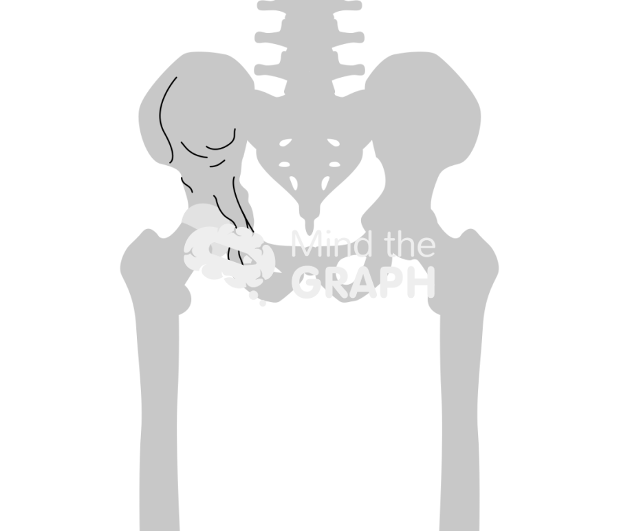 Pagets disease hip arthritis bone Icons, Symbols, Pictures, and Images