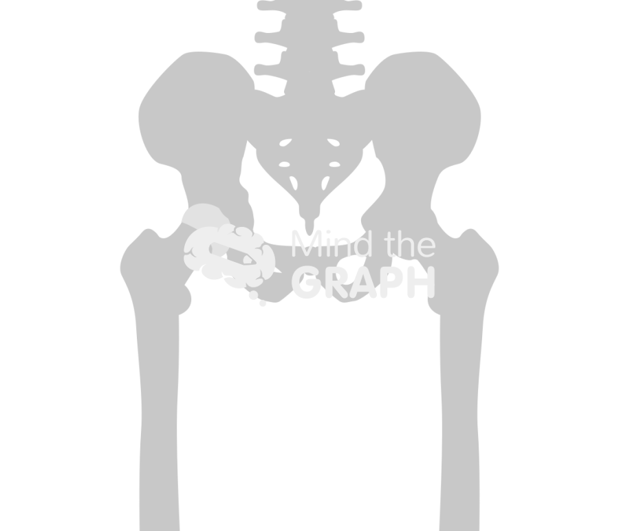 Pagets disease hip arthritis bone Icons, Symbols, Pictures, and Images