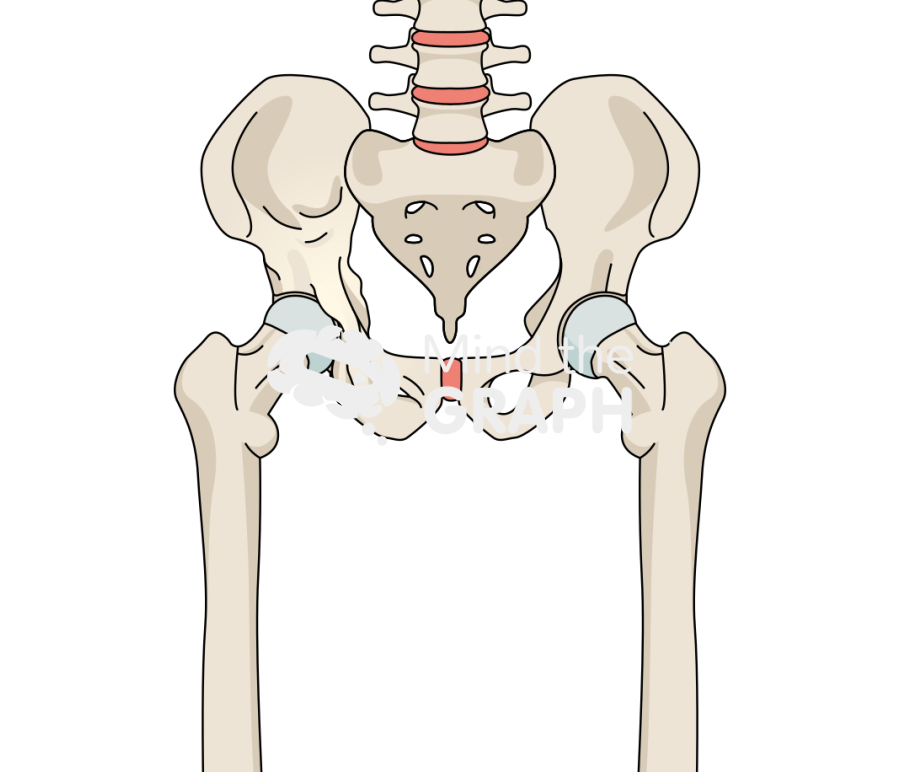 Pagets disease hip arthritis bone full Icons, Symbols, Pictures, and Images
