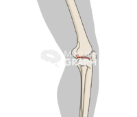 Patella baja lateral body Icons, Symbols, Pictures, and Images